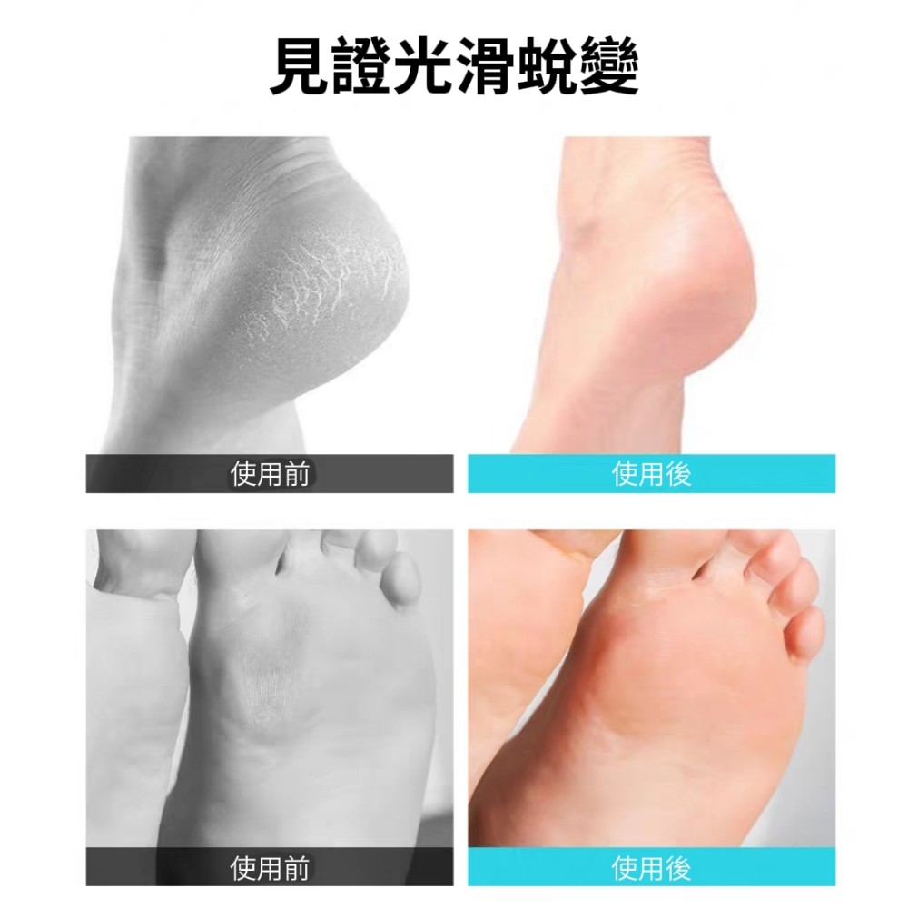 【Glace】去死皮嫩足跟修腳器/磨皮器 涼鞋必備 後跟修護 絲襪不勾紗