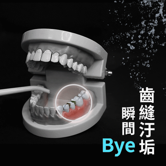 ANCO無級脈衝便攜充電沖牙機MA-003PID-000