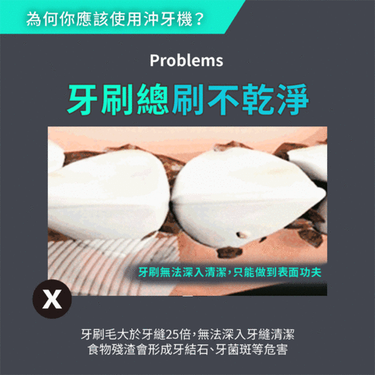 ANCO無級脈衝便攜充電沖牙機MA-003PID-000