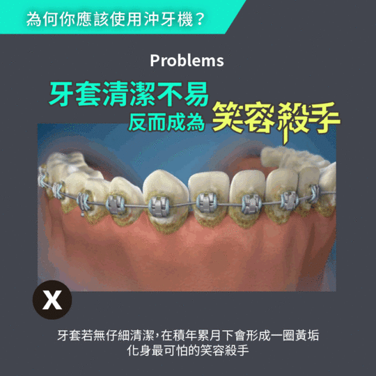 ANCO無級脈衝便攜充電沖牙機MA-003PID-000