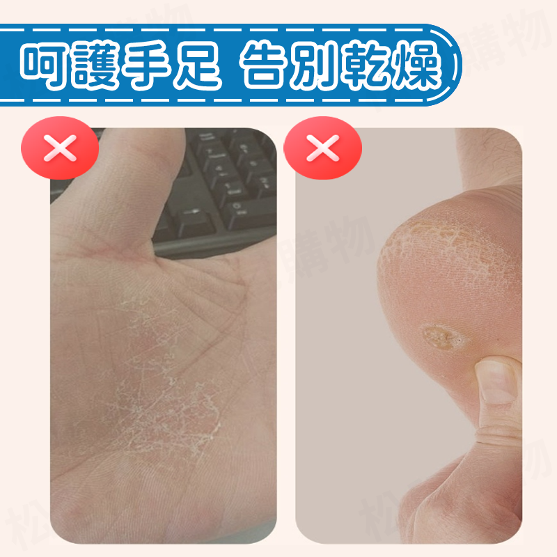 日本品牌手指防裂貼 100入/盒 護膚 透氣 腳跟龜裂 防磨 護手 護腳 足貼 手足修護 貼布 非OK蹦 獨立包裝