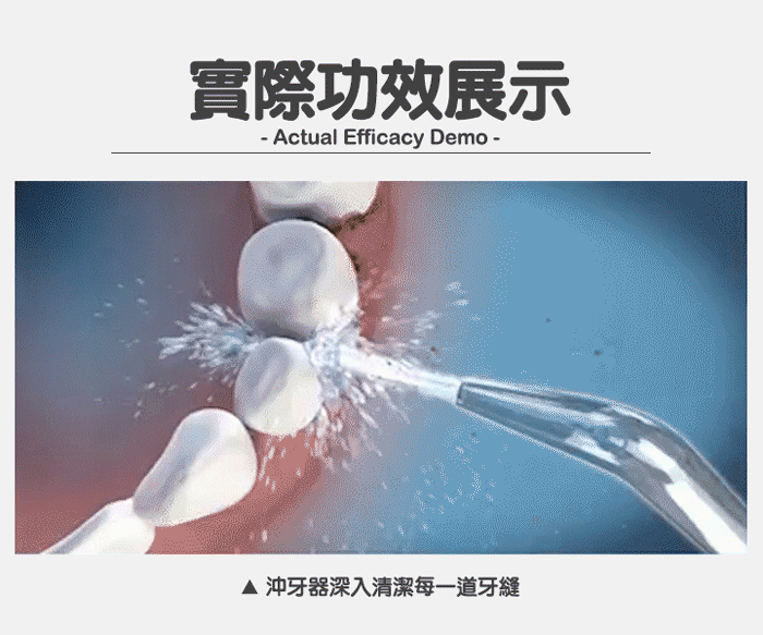 【家適帝】專業級全銅高壓沖牙機 洗牙器/口腔保健/贈噴頭收納盒