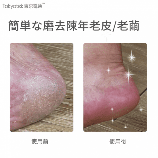 【東京電通】360度美足腳皮機