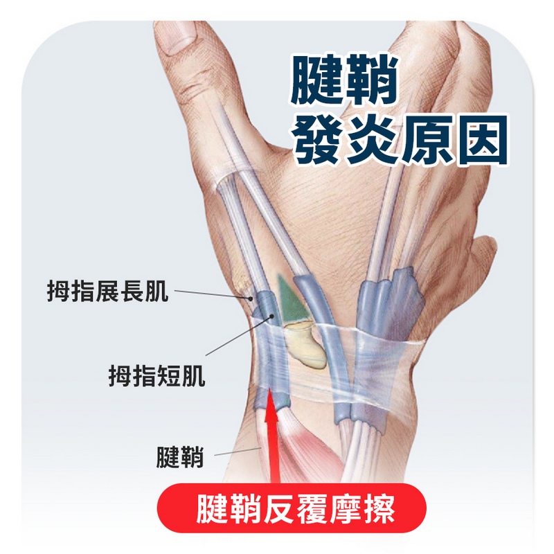 拇指護腕 支撐護腕 護腕 拇指護腕拇指肌腱 手指護具 護手腕 