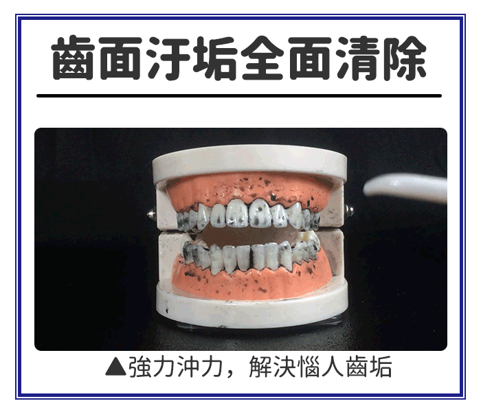 【家適帝】專業級全銅高壓沖牙機 洗牙器/口腔保健/贈噴頭收納盒
