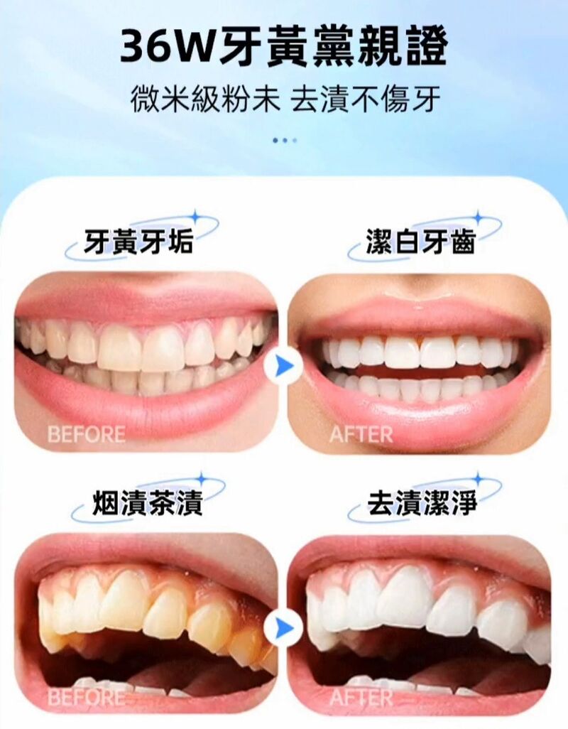益生菌白牙美白牙粉 一刷亮白 牙粉 牙齒美白 去漬去黃 白牙素+益生菌