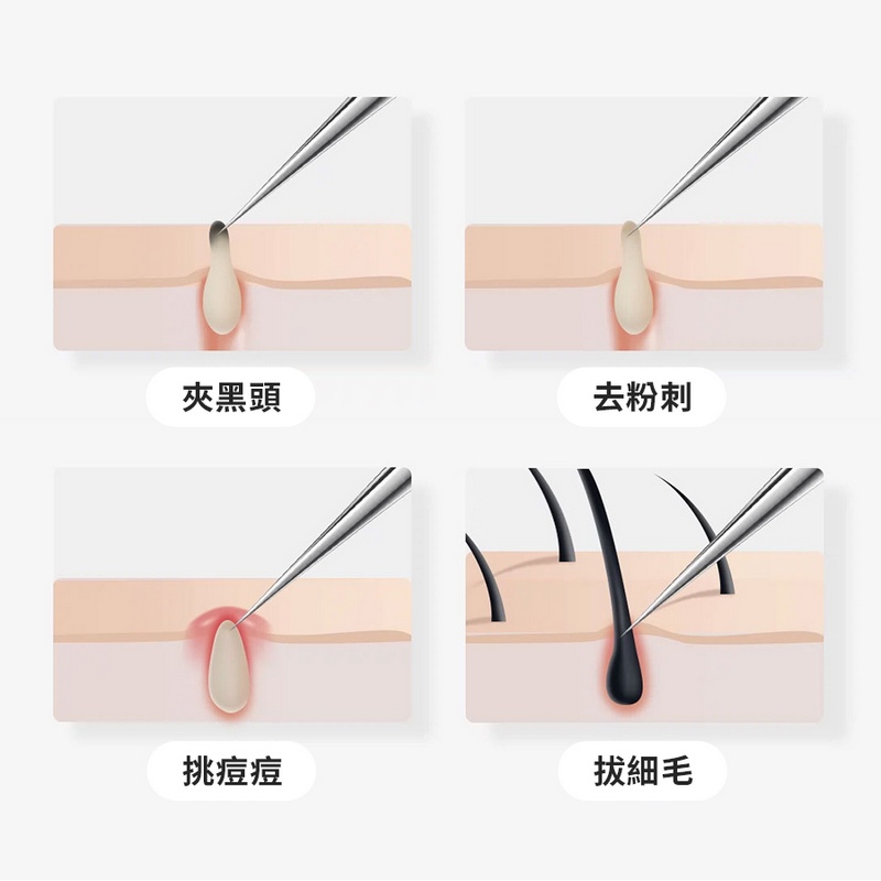 不鏽鋼粉刺夾套組