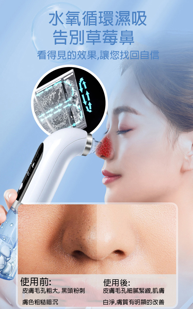 【呈云】注水小氣泡電動臉部清潔儀 黑頭粉刺機