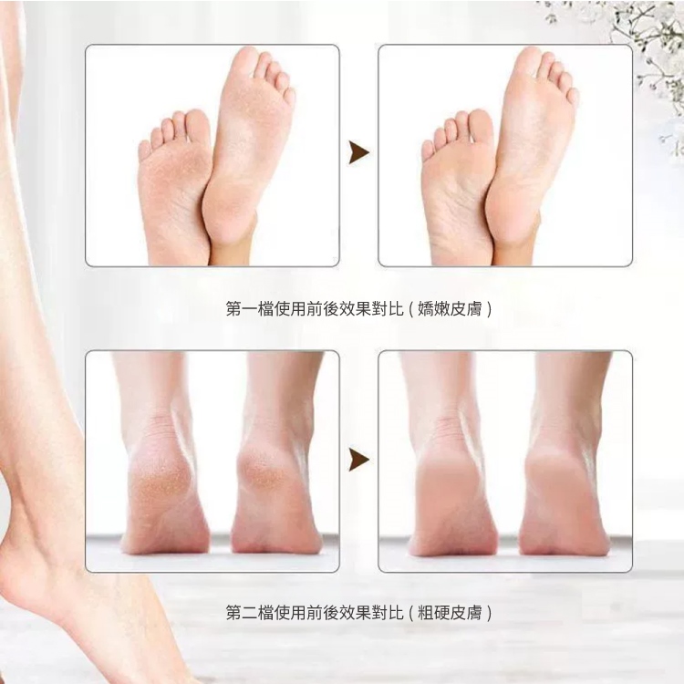 充電式電動去死皮磨腳皮機 去角質 電動磨腳機