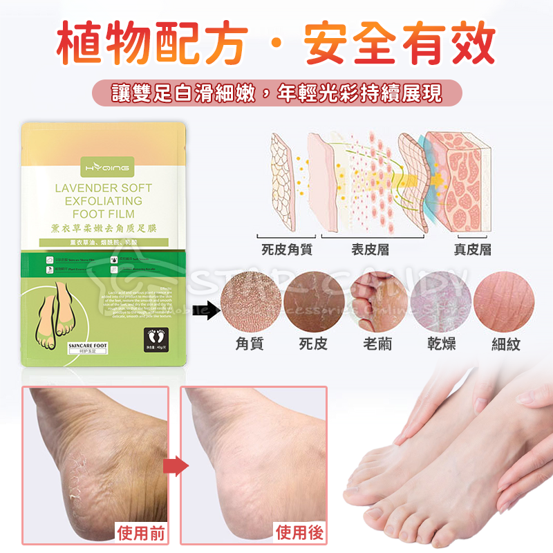 去角質脫皮腳膜