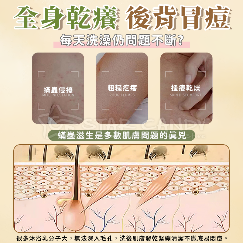 硫磺除螨液體皂 硫磺沐浴露 