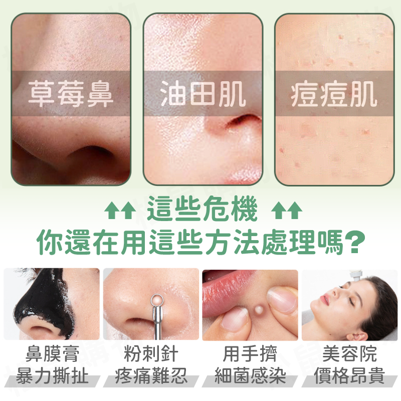 去黑頭粉刺美容鏟皮刀