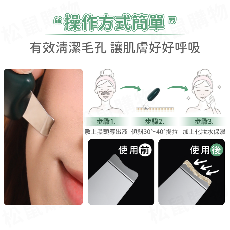 去黑頭粉刺美容鏟皮刀