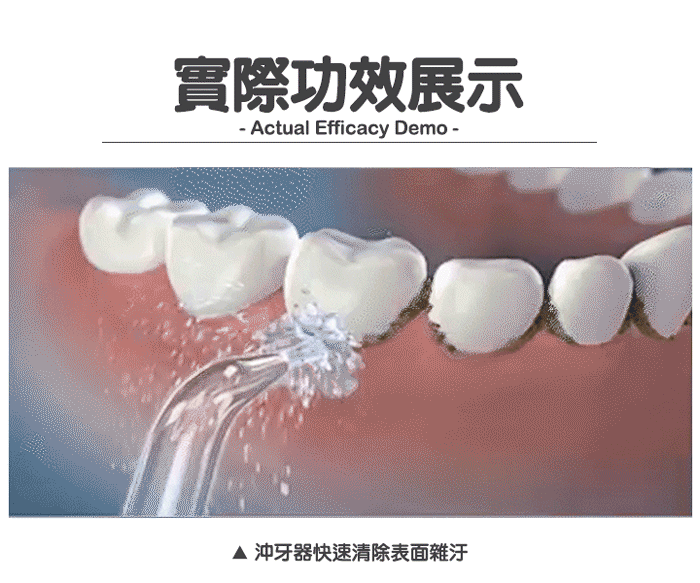 【家適帝】專業級全銅高壓沖牙機 洗牙器/口腔保健/贈噴頭收納盒