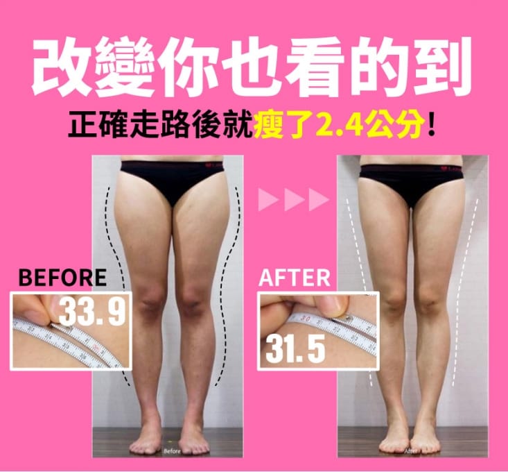 【一點】美腿導正分趾套 分趾器 分趾套 假跨寬(2入/組)
