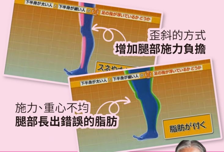 【一點】美腿導正分趾套 分趾器 分趾套 假跨寬(2入/組)
