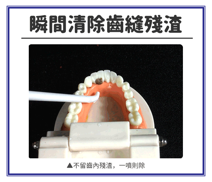 【家適帝JUSTY ORAL】十段高壓脈衝沖牙機 洗牙機/口腔保健/可加購噴頭