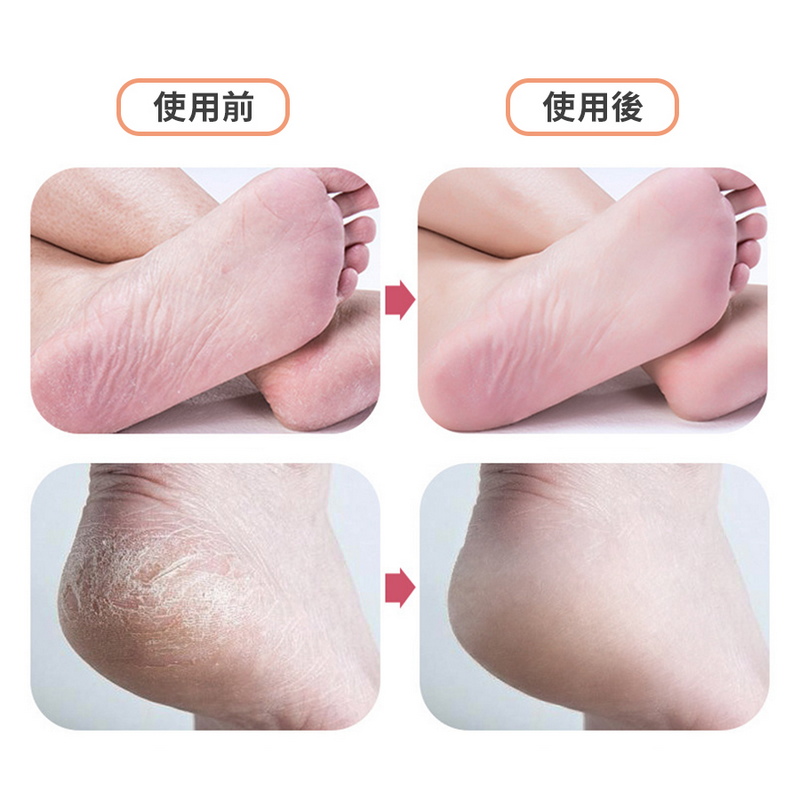 納米玻璃磨腳皮器 腳底去角質 磨腳石